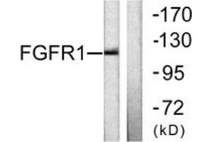 Western blot analysis of extracts from 293 cells, using FGFR1 (Ab-654) Antibody. (FGFR1 Antikörper  (AA 626-675))
