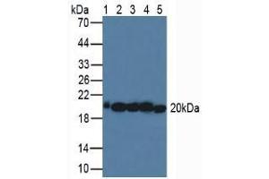 Western blot analysis of (1) Human Serum, (2) Porcine Liver Tissue, (3) Human HeLa cells, (4) Porcine Brain Tissue and (5) Human MCF-7 Cells. (SOD2 Antikörper  (AA 25-222))