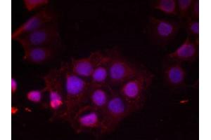 Immunofluorescence staining of methanol-fixed MCF cells using Estrogen Receptor-a(Phospho-Ser118) Antibody. (Estrogen Receptor alpha Antikörper  (pSer118))