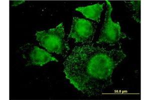 Immunofluorescence of monoclonal antibody to SGK2 on HeLa cell. (SGK2 Antikörper  (AA 293-367))