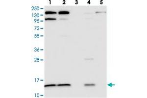 Western blot analysis of Lane 1: RT-4, Lane 2: U-251 MG, Lane 3: Human Plasma, Lane 4: Liver, Lane 5: Tonsil with CMC1 polyclonal antibody . (CMC1 Antikörper)