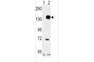 Western blot analysis of TEK using rabbit polyclonal TEK Antibody using 293 cell lysates (2 ug/lane) either nontransfected (Lane 1) or transiently transfected with the TEK gene (Lane 2).