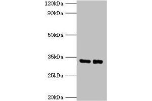 Western blot All lanes: SRM antibody at 2 μg/mL Lane 1: EC109 whole cell lysate Lane 2: 293T whole cell lysate Secondary Goat polyclonal to rabbit IgG at 1/15000 dilution Predicted band size: 34 kDa Observed band size: 34 kDa (Spermidine Synthase Antikörper  (AA 17-302))