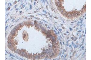 Immunohistochemical staining of formalin-fixed paraffin-embedded human fetal kidney tissue showing cytoplasmic staining with ECH1 polyclonal antibody  at 1 : 100 dilution.