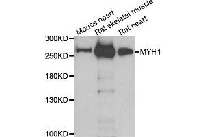 Western blot analysis of extracts of various cell lines, using MYH1 antibody (ABIN5974170) at 1/1000 dilution. (MYH1 Antikörper)
