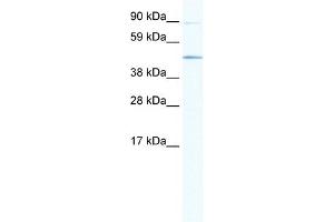 WB Suggested Anti-SITPEC Antibody Titration:  1. (ECSIT Antikörper  (Middle Region))
