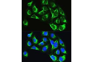 Immunofluorescence analysis of U2OS cells using LARS Rabbit pAb (ABIN7268238) at dilution of 1:100. (LARS Antikörper  (AA 1-270))