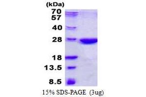 Image no. 1 for Nonhomologous End-Joining Factor 1 (NHEJ1) protein (His tag) (ABIN6387017) (NHEJ1 Protein (His tag))