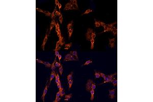 Immunofluorescence analysis of C6 cells using EPS15 Rabbit pAb  at dilution of 1:200 (40x lens). (EPS15 Antikörper  (AA 660-840))