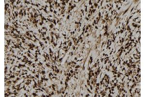 ABIN6277748 at 1/100 staining Human gastric tissue by IHC-P. (MCM5 Antikörper  (N-Term))