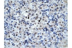 MAPK14 antibody was used for immunohistochemistry at a concentration of 4-8 ug/ml to stain Hepatocytes (arrows) in Human Liver. (MAPK14 Antikörper  (C-Term))