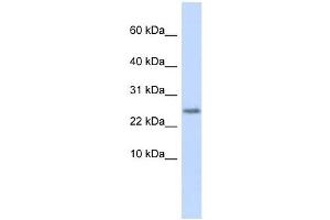 Cystatin 9 antibody used at 1 ug/ml to detect target protein. (CST9 Antikörper)