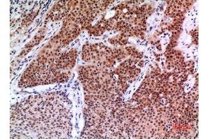 Immunohistochemistry (IHC) image for anti-Endothelial PAS Domain Protein 1 (EPAS1) (Ser343) antibody (ABIN3187839)