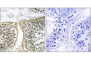 Immunohistochemistry analysis of paraffin-embedded human testis, using Cytochrome P450 2C8 Antibody. (CYP2C8 Antikörper  (AA 241-290))