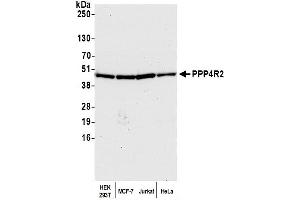 Western Blotting (WB) image for anti-Protein Phosphatase 4, Regulatory Subunit 2 (PPP4R2) (C-Term) antibody (ABIN7453641) (PPP4R2 Antikörper  (C-Term))