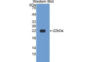 Western blot analysis of the recombinant protein. (NEU1 Antikörper  (AA 141-286))