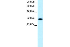WB Suggested Anti-RAX Antibody Titration:  0. (RAX Antikörper  (N-Term))