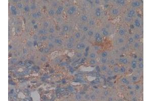 Detection of CFH in Rat Liver Tissue using Polyclonal Antibody to Complement Factor H (CFH)