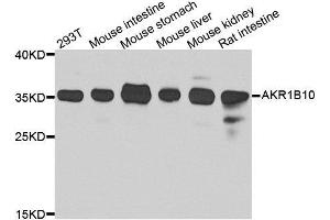 Western blot analysis of extracts of various cell lines, using AKR1B10 antibody. (AKR1B10 Antikörper  (AA 1-316))