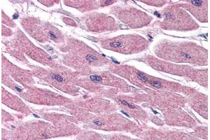 Human Heart (formalin-fixed, paraffin-embedded) stained with STRADB antibody ABIN351469 at 3. (STRADB Antikörper  (AA 406-418))