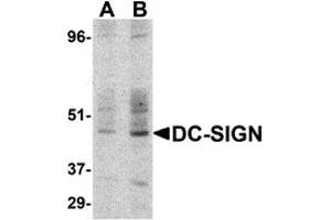 Western Blotting (WB) image for anti-CD209 (CD209) (C-Term) antibody (ABIN1030357) (DC-SIGN/CD209 Antikörper  (C-Term))