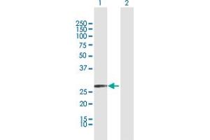 Western Blot analysis of KLK2 expression in transfected 293T cell line by KLK2 MaxPab polyclonal antibody. (Kallikrein 2 Antikörper  (AA 1-223))