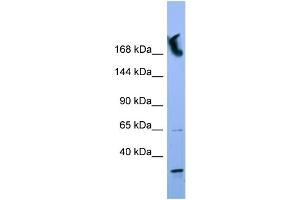 WB Suggested Anti-NUP155 Antibody Titration: 0. (NUP155 Antikörper  (N-Term))