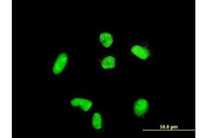 Immunofluorescence of purified MaxPab rabbit antibody to ACTN4 on HeLa cell. (alpha Actinin 4 Antikörper  (AA 1-911))