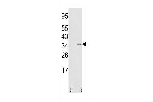 Western blot analysis of SNAI1 (arrow) using rabbit polyclonal hSNAI1-D24 (ABIN388809 and ABIN2850429). (SNAIL Antikörper  (N-Term))