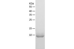 Western Blotting (WB) image for Zinc Finger, BED-Type Containing 1 (ZBED1) (AA 3-100) protein (His tag) (ABIN7125806) (ZBED1 Protein (AA 3-100) (His tag))