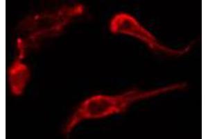 ABIN6274208 staining HepG2 cells by IF/ICC.