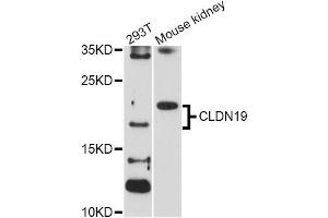 Western blot analysis of extracts of various cell lines, using CLDN19 Antibody (ABIN1871893) at 1:1000 dilution. (Claudin 19 Antikörper)