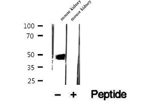 Western blot analysis of extracts of mouse kidney tissue, using DOPA decarboxylase antibody. (DDC Antikörper  (Internal Region))