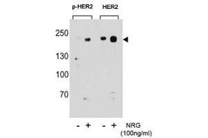 Western blot analysis of extracts from T47D cells, untreated or treated with NRG, using p-HER2 antibody (left) or nonphos Ab (right).