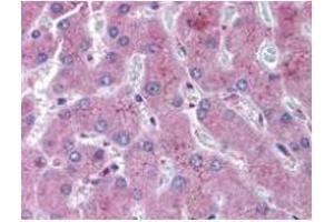 anti-NOTCH 2 antibody was diluted 1:500 to detect NOTCH 2 in human liver tissue. (NOTCH2 Antikörper  (N-Term))