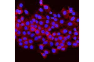IF analysis of Aldolase/ALDOB using anti-Aldolase/ALDOB antibody (ABIN7602563).