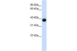 DEGS1 antibody used at 1 ug/ml to detect target protein. (DEGS1 Antikörper)