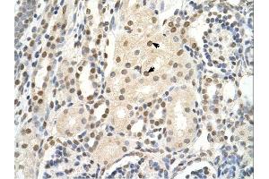 PUF60 antibody was used for immunohistochemistry at a concentration of 4-8 ug/ml. (PUF60 Antikörper  (C-Term))