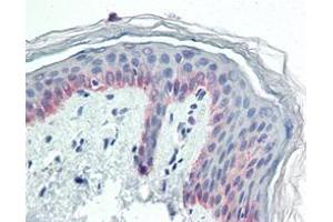 Immunohistochemical analysis of paraffin-embedded human skin tissues using CK5 mouse mAb. (Cytokeratin 5 Antikörper)