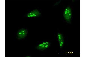 Immunofluorescence of purified MaxPab antibody to NOL7 on HeLa cell. (NOL7 Antikörper  (AA 1-257))