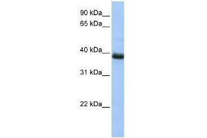 SPO11 antibody used at 1 ug/ml to detect target protein. (SPO11 Antikörper)