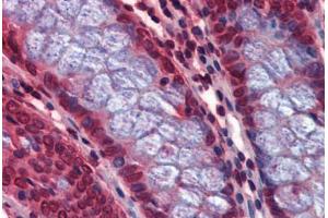Human Colon: Formalin-Fixed, Paraffin-Embedded (FFPE) (Calcyphosine 2 Antikörper  (Internal Region))