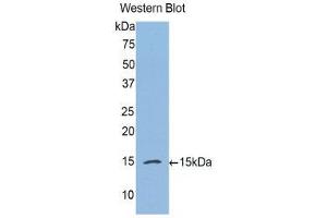 Western Blotting (WB) image for anti-Complement Factor B (CFB) (AA 270-388) antibody (ABIN1175357) (Complement Factor B Antikörper  (AA 270-388))