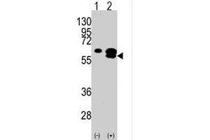 Western blot analysis of CAMK1G (arrow) using rabbit polyclonal CAMK1G polyclonal antibody . (CAMK1G Antikörper  (C-Term))