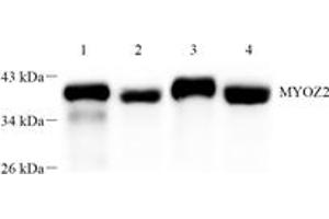 Western blot analysis of Myoz2 (ABIN7074744) at dilution of 1: 1000,Lane 1: Mouse heart muscle tissue lysate,Lane 2: Mouse skeletal muscle tissue lysate,Lane 3: Rat heart muscle tissue lysate,Lane 4: Rat skeletal muscle tissue lysate