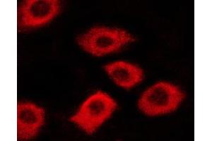 ABIN6267340 staining A431 cells by ICC/IF. (c-MET Antikörper  (pTyr1003))