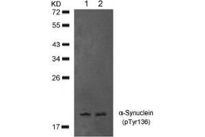 Image no. 1 for anti-Synuclein, alpha (SNCA) (pTyr136) antibody (ABIN401577) (SNCA Antikörper  (pTyr136))