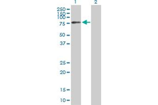 TRMT2A Antikörper  (AA 1-625)