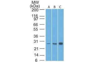 Western Blot Analysis of Bcl-2 in human A) HeLa, B) A549 and C) MCF7 lysate using Bcl-2 Mouse Monoclonal Antibody (8C8). (Bcl-2 Antikörper  (AA 41-54))