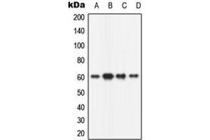 Western blot analysis of CaMK2 beta expression in HeLa (A), mouse brain (B), rat brain (C), PC12 (D) whole cell lysates. (CAMK2B Antikörper  (N-Term))